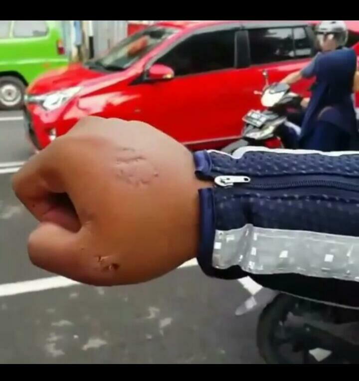 Aduh....!  Amak-Amak Gigit Polisi