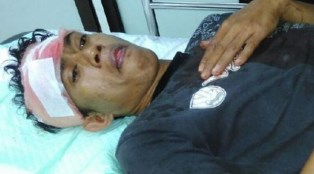 Tak Terima Dibilang Dukun Santet Tetangga Diclurit