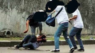 Dikeroyok Sesama Pelajar Siswa SMPN 2 Sanden, Bantul Geger Otak